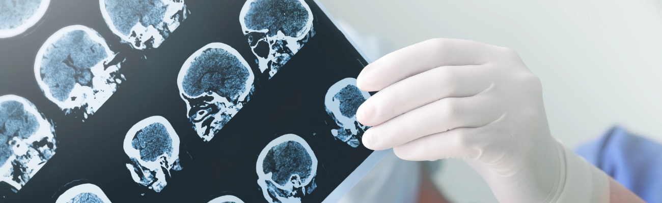 neuropsiquiartria