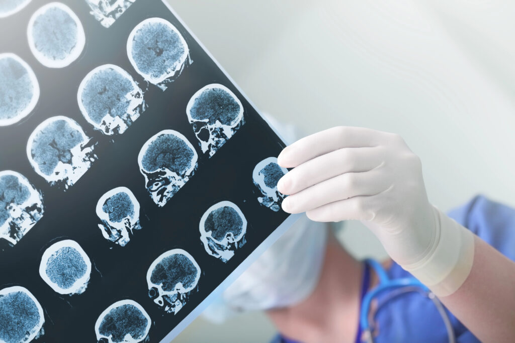 Neuropsiquiatria